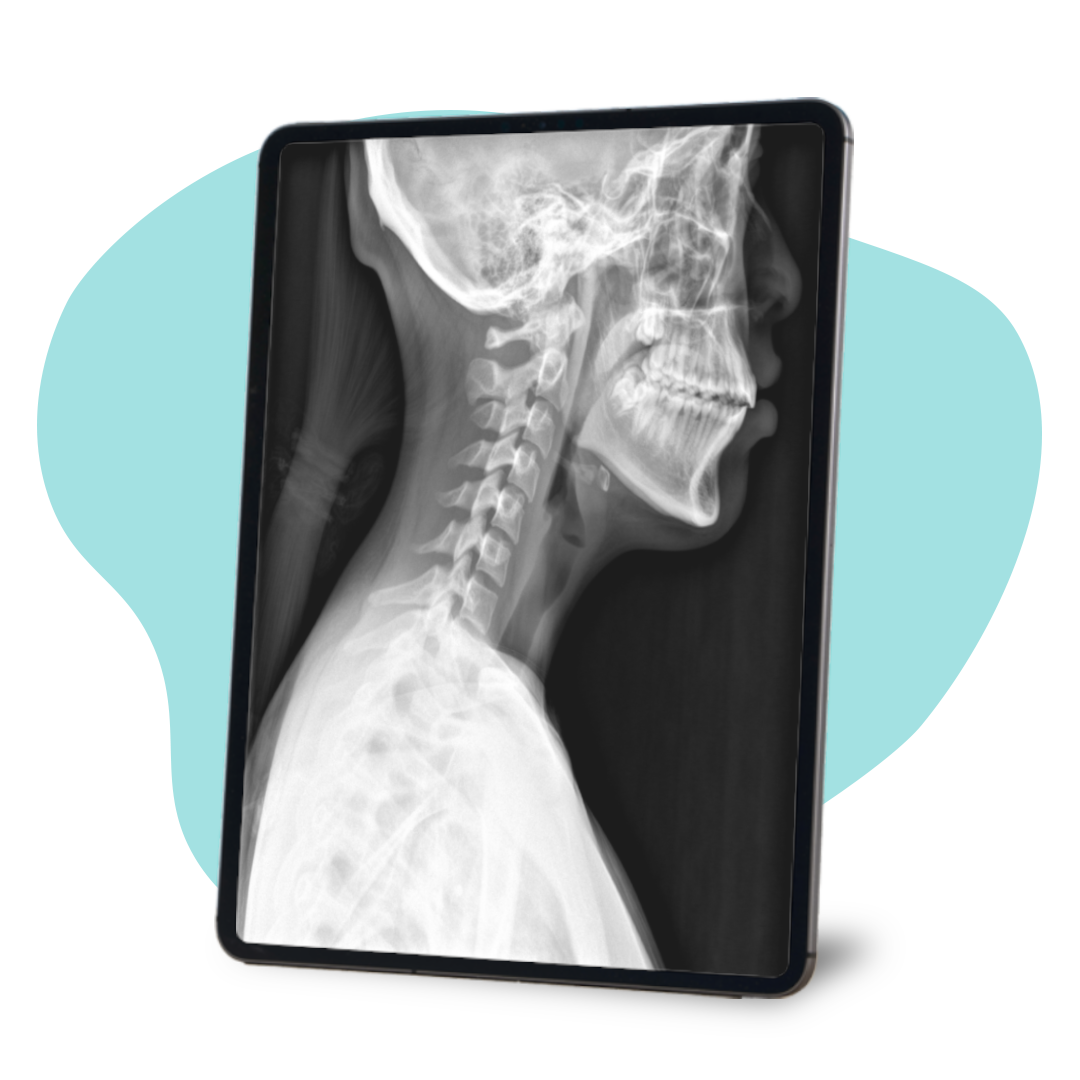 ¿Qué es un sistema PACS (RIS/PACS)?